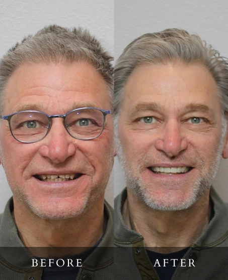 Family Dentistry in Moscow